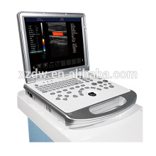 tragbare Farb-Doppler-Ultraschall-Maschine 4D &amp; Laptop Ultraschall-Scanner DWC60 PLUS